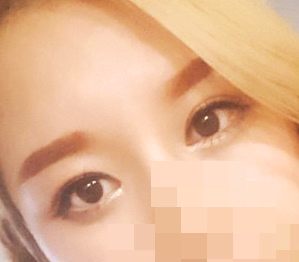 目の整形、強くおすすめします！！！！