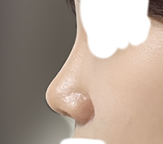 A balanced nose