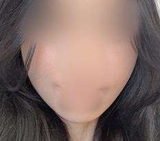 効果がすごくいいです