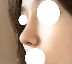 鼻先のディテールが良い
