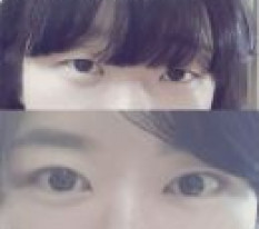 目の手術をして可愛くなったって~ haha