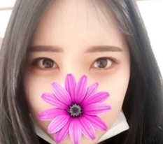 Dual canthoplasty: stop worrying and GO