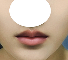 My lip line is amazing haha