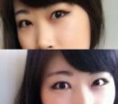 だから整形手術するんだと思いました 効果がすごい >ㅁ<