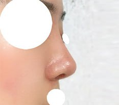 繊細な鼻の完成!!!