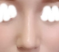 鼻は現代美学整形外科!!