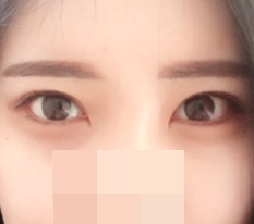 デュアルトリミングのおかげです