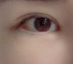 幸い良い結果が出ました
