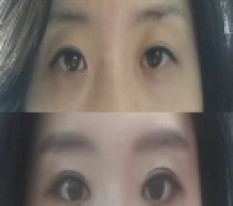 眠そうな目から脱出したレビュー