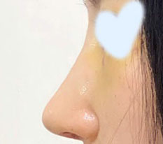 本当に正解だったと思うし、スッキリしています