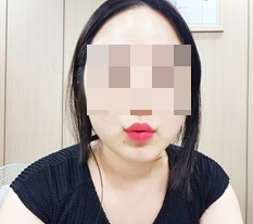 口角レビューを残します！！