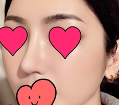 再手術レビューを残します~*_*