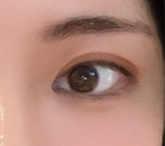 手術がうまくいきました