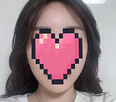 卵型フェイス♥