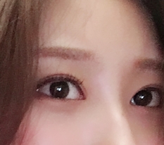 目の整形はやっぱり現代美学~