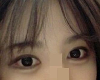 目整形のレビューです~