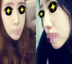 すっとした鼻筋でクールな都会女子になりました