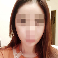 頬骨縮小、最高です ㅎㅎ