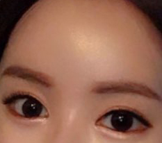 現代美学整形外科 is the best!