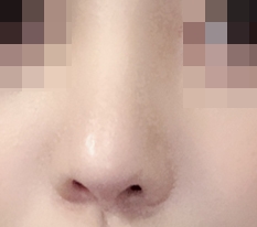 とがっていた鼻先が柔らかくなりました!