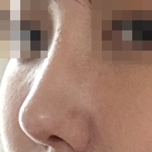 ラインをきれいに整えてくれました ㅎ